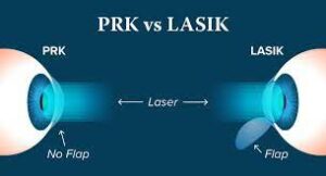Eye Surgery - PRK vs LASIK